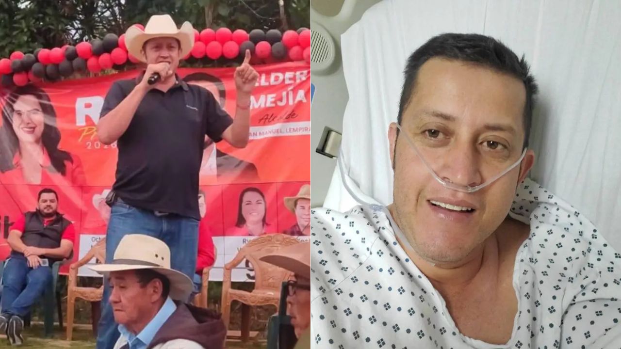 Imagen de ¿Qué es el 'corazón artificial' de L10.5 millones que ocupa diputado de Libre para vivir?