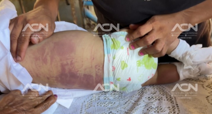 Imagen de cuerpo de nota