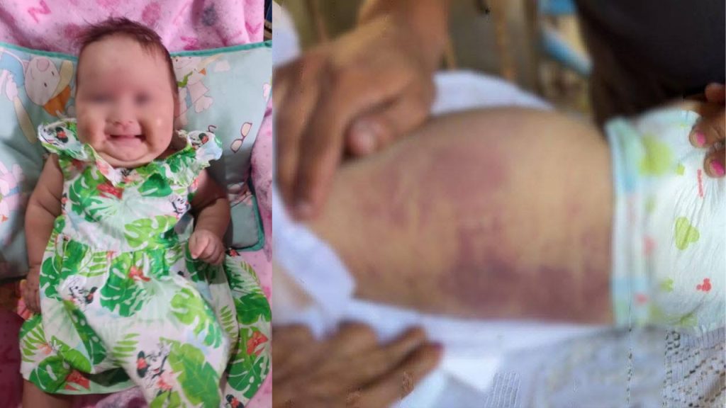 Imagen de cuerpo de nota