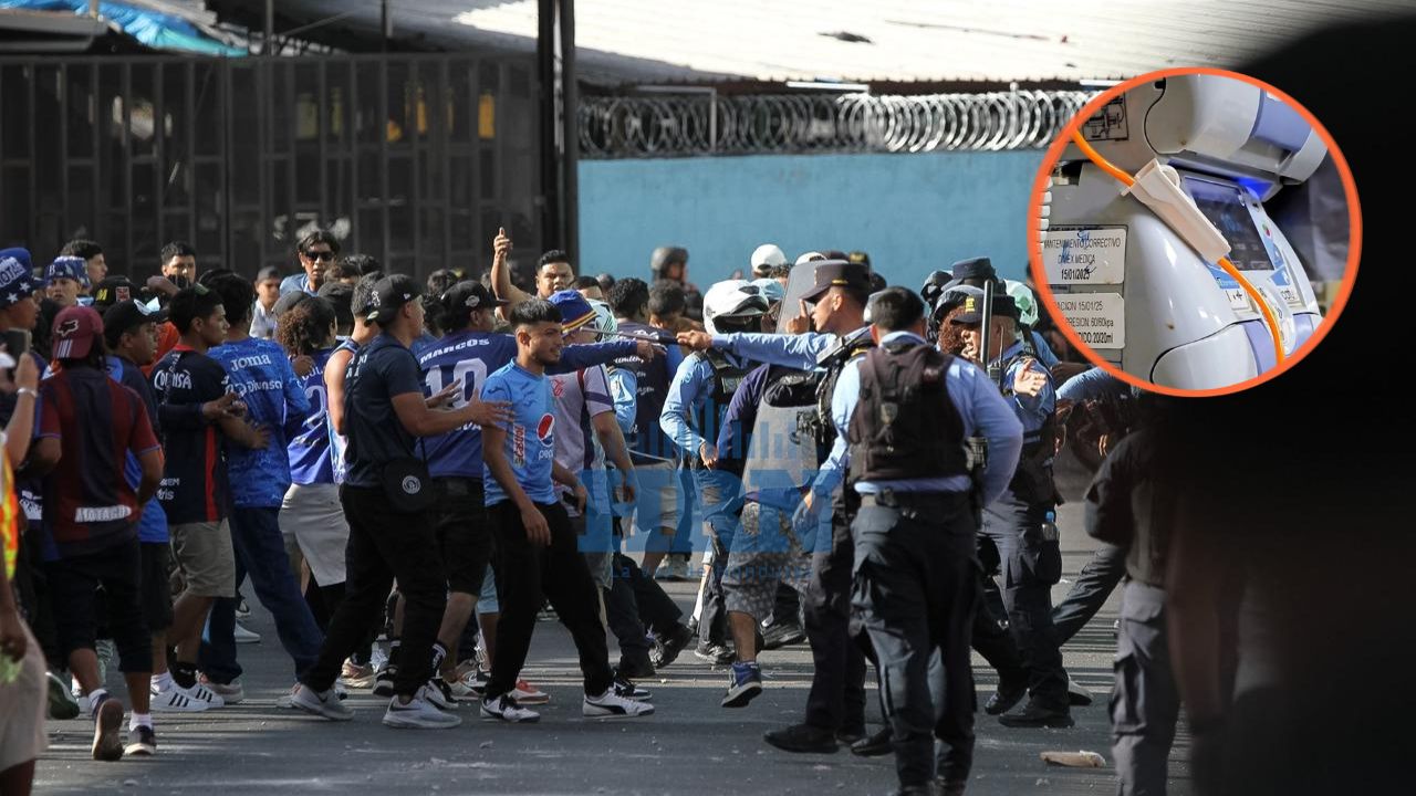 Imagen de 'Volví a la vida': aficionado se recupera tras disturbios previos al clásico capitalino