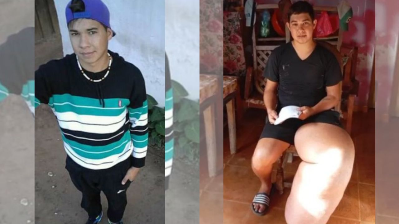 Imagen principal de Un golpe en el fútbol le cambió la vida: Héctor Ortiz y su pierna inflamada