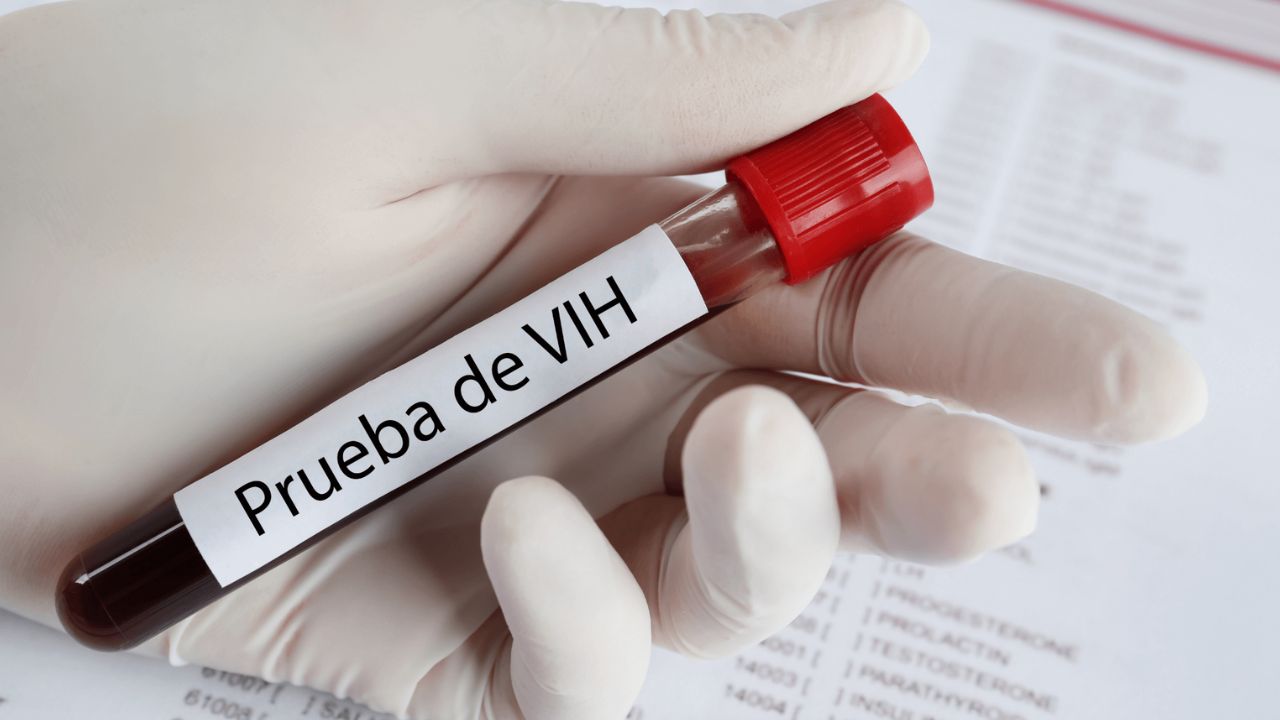¿Pueden solicitarle una prueba de VIH para aspirar a una plaza o en su trabajo actual? Imagen principal de ¿Pueden solicitarle una prueba de VIH para aspirar a una plaza o en su trabajo actual?