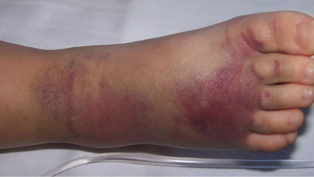 Imagen de cuerpo de nota