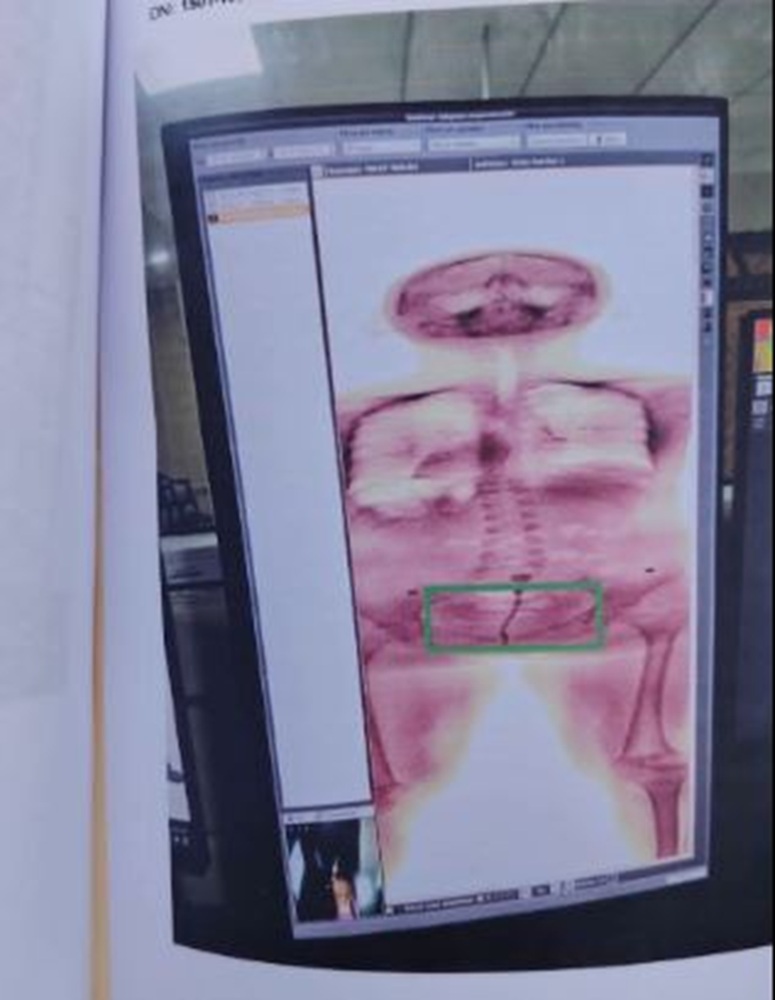 Imagen de cuerpo de nota