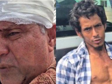 Imagen de Hijo ataca salvajemente a su padre y lo deja hospitalizado en La Ceiba