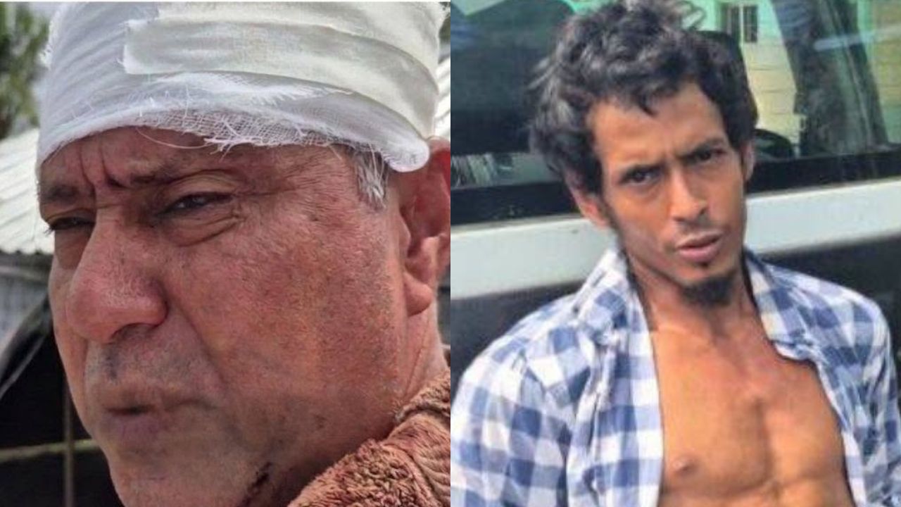 Hijo ataca salvajemente a su padre y lo deja hospitalizado en La Ceiba Imagen principal de Hijo ataca salvajemente a su padre y lo deja hospitalizado en La Ceiba