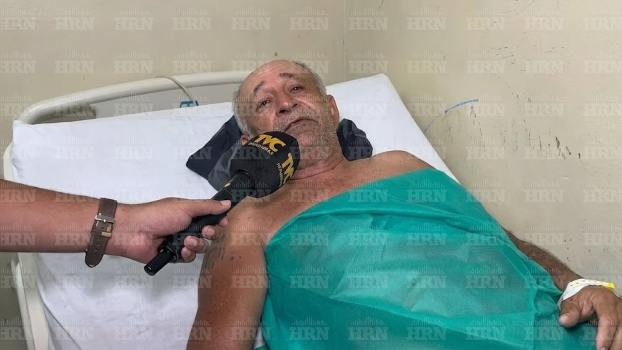 'Solo sentí el golpe': José Navas, sobreviviente de impacto de un rayo en La Ceiba Imagen principal de 'Solo sentí el golpe': José Navas, sobreviviente de impacto de un rayo en La Ceiba