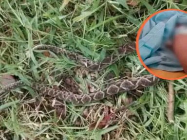Imagen de Jugaba en el jardín: niña de 4 años muere tras mordedura de barba amarilla