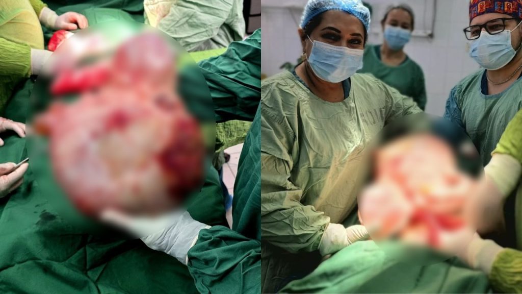 Imagen de cuerpo de nota