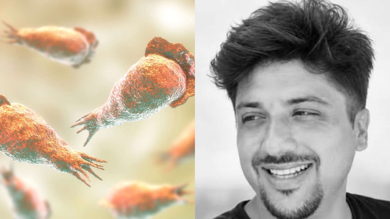 Joven instructor muere por peligrosa ameba Naegleria fowleri: esto se sabe Imagen principal de Joven instructor muere por peligrosa ameba Naegleria fowleri: esto se sabe