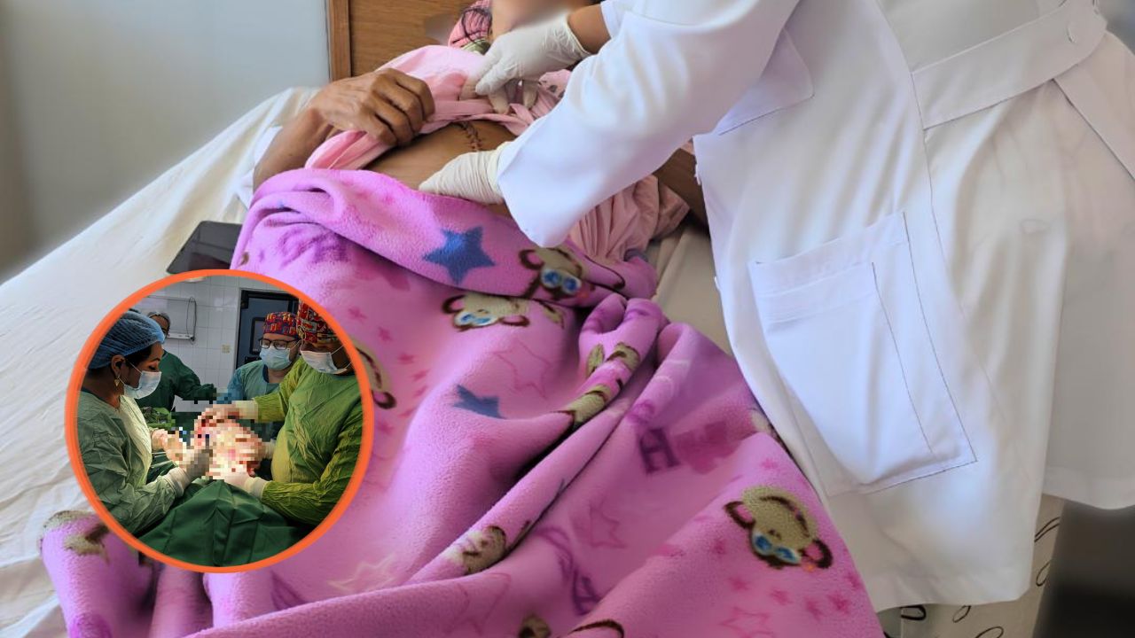 Impresionante: extirpan ovario gigante de 20 libras a paciente en el Hospital Escuela Imagen principal de Impresionante: extirpan ovario gigante de 20 libras a paciente en el Hospital Escuela