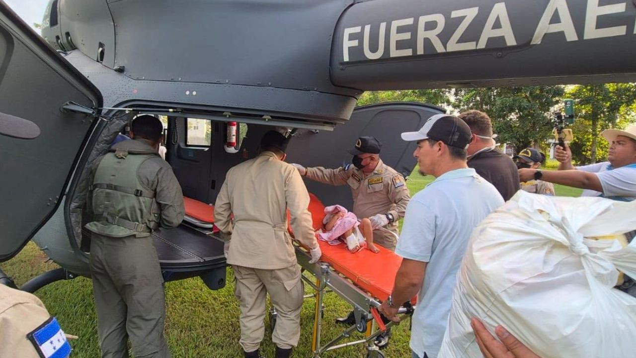 Bebé de 18 meses lucha por su vida tras sufrir quemaduras con agua hirviendo en Tocoa Imagen principal de Bebé de 18 meses lucha por su vida tras sufrir quemaduras con agua hirviendo en Tocoa