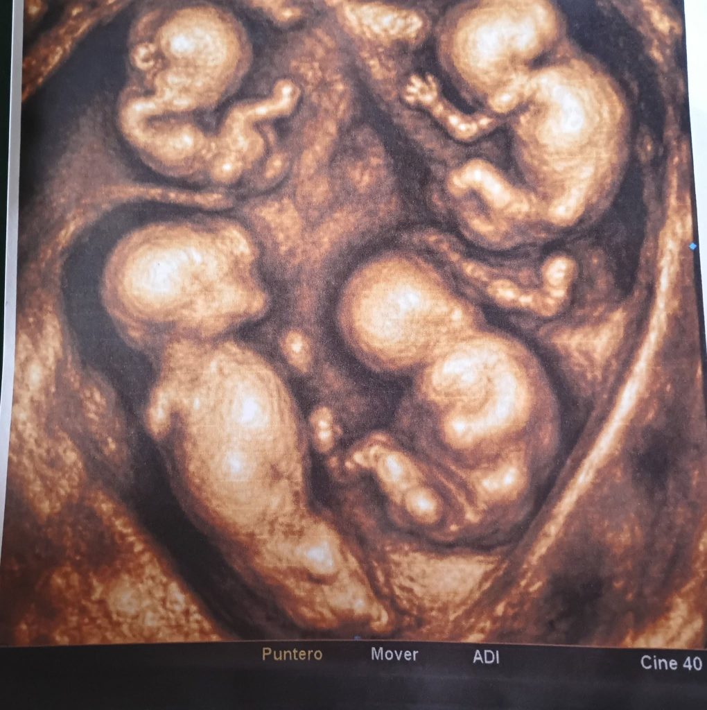 Imagen de cuerpo de nota