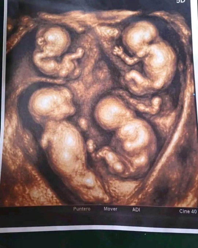 Imagen de cuerpo de nota