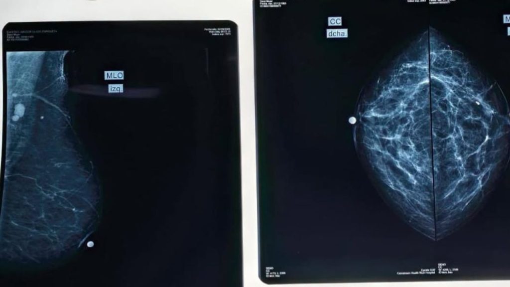 Imagen de cuerpo de nota