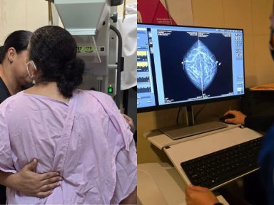 Imagen de Mamografías gratis en el Hospital Escuela: quiénes pueden acceder y qué deben hacer