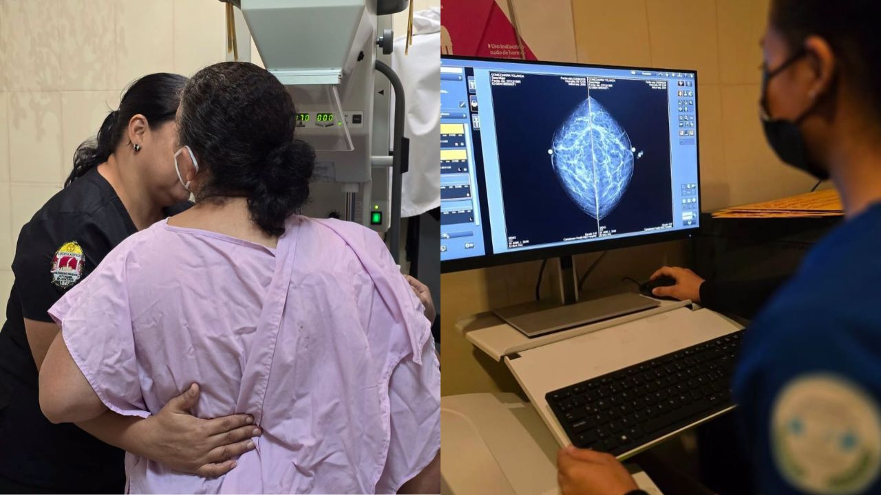 Mamografías gratis en el Hospital Escuela: quiénes pueden acceder y qué deben hacer Imagen principal de Mamografías gratis en el Hospital Escuela: quiénes pueden acceder y qué deben hacer