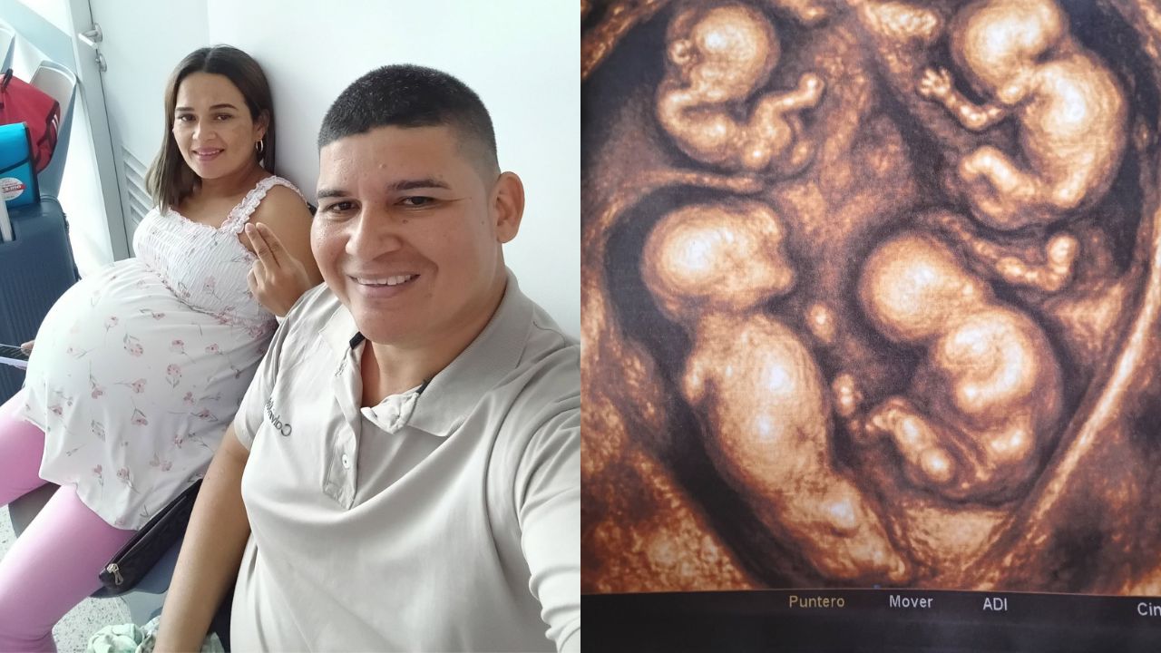 ¡Cuatro iguales! Nacen cuatrillizos idénticos en Colombia y revelan sus nombres Imagen principal de ¡Cuatro iguales! Nacen cuatrillizos idénticos en Colombia y revelan sus nombres